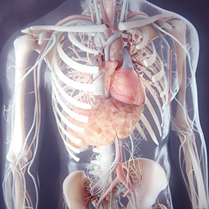 Lp(a) in Atherosclerotic Cardiovascular Disease Heart Diagram